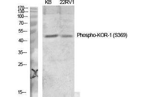 Western Blot (WB) analysis of specific cells using Phospho-KOR-1 (S369) Polyclonal Antibody. (OPRK1 抗体  (pSer369))