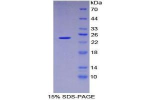SDS-PAGE analysis of Mouse DVL1 Protein. (DVL1 蛋白)