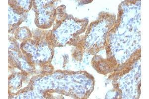 Immunohistochemistry (IHC) image for anti-Mastermind-Like 2 (MAML2) antibody (ABIN6940961)