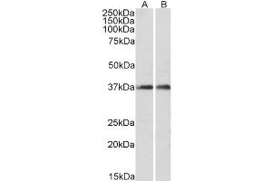 Western Blot (0. (ARPC1A 抗体  (C-Term))