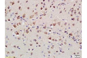 Formalin-fixed and paraffin embedded mouse brain labeled with Anti-SLC4A4 Polyclonal Antibody, Unconjugated at 1:400 followed by conjugation to the secondary antibody and DAB staining (kNBC (AA 1-100) 抗体)