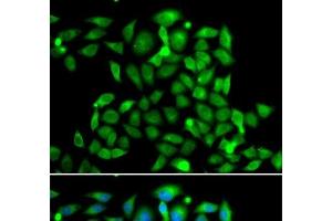 Immunofluorescence analysis of A549 cells using CLASP1 Polyclonal Antibody (CLASP1 抗体)