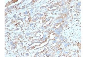 Immunohistochemistry (IHC) image for anti-CD274 (PD-L1) (AA 39-191) antibody (ABIN6939571)