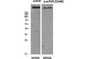 Western Blot (WB) analysis of specific cells using mTOR Polyclonal Antibody. (MTOR 抗体  (Ser396))