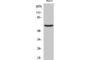 Western Blot analysis of HepG2 cells using Cytokeratin 5 Polyclonal Antibody diluted at 1:1000.