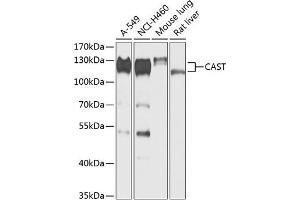Western blot analysis of extracts of various cell lines, using CAST antibody (ABIN6133634, ABIN6137983, ABIN6137985 and ABIN6217769) at 1:1000 dilution. (Calpastatin 抗体  (AA 550-650))