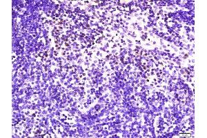 Immunohistochemistry (Paraffin-embedded Sections) (IHC (p)) image for anti-Killer Cell Lectin-Like Receptor Subfamily K, Member 1 (KLRK1) (AA 121-219) antibody (ABIN730078)