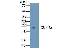 Detection of Recombinant VEGF165, Human using Polyclonal Antibody to Vascular Endothelial Growth Factor 165 (VEGF165) (VEGF 165 (AA 28-191) 抗体)