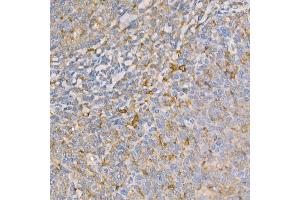 Immunohistochemistry of paraffin-embedded human tonsil using GSDMD (Full Length+N terminal) Rabbit pAb  at dilution of 1:100 (40x lens). (GSDMD 抗体)