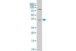 GPR62 polyclonal antibody (A01), Lot # 050926JC01. (GPR62 抗体  (AA 314-368))