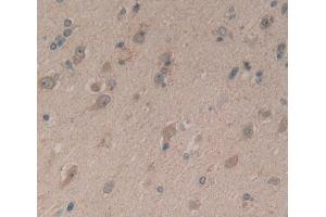 Used in DAB staining on fromalin fixed paraffin- embedded brain tissue (Complexin 1 抗体  (AA 1-134))