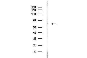 anti-Runt-Related Transcription Factor 2 (RUNX2) (pSer319) antibody