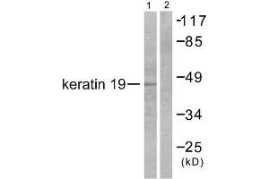 Western Blotting (WB) image for anti-Keratin 19 (KRT19) (Internal Region) antibody (ABIN1848635) (Cytokeratin 19 抗体  (Internal Region))