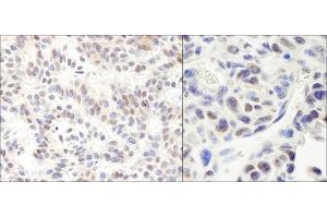 Immunohistochemistry (IHC) image for anti-High Mobility Group Box 3 (HMGB3) (AA 125-175) antibody (ABIN7453713)