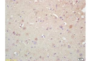 Formalin-fixed and paraffin embedded rat brain labeled with Rabbit Anti KIF5A/NKHC1 Polyclonal Antibody, Unconjugated (ABIN1387674) at 1:200 followed by conjugation to the secondary antibody and DAB staining (K5A/ NKHC1 (AA 201-300) 抗体)