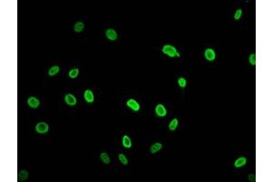 Immunofluorescence staining of Hela cells (treated with 30mM sodium butyrate for 4h) with ABIN7139195 at 1:2. (HIST1H2AG 抗体  (acLys74))