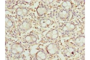 Immunohistochemistry of paraffin-embedded human colon tissue using ABIN7149683 at dilution of 1:100 (DENND5A 抗体  (AA 1-300))