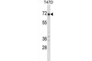 Western Blotting (WB) image for anti-Glypican 2 (GPC2) antibody (ABIN2998770) (GPC2 抗体)