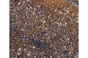Immunohistochemistry of Human tonsil using KCNK17 Polyclonal Antibody at dilution of 1:60 (KCNK17 抗体)