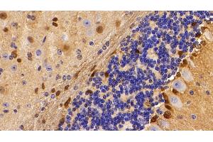 Immunohistochemistry (IHC) image for anti-S100 Calcium Binding Protein B (S100B) (AA 1-92) antibody (ABIN7432073)