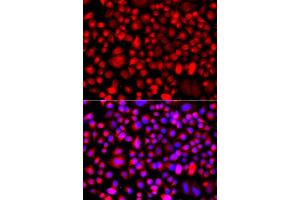 Immunofluorescence analysis of A549 cell using ALG1 antibody. (ALG1 抗体)