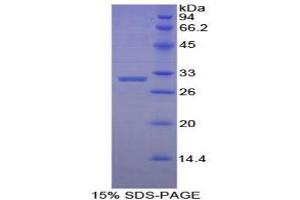 SDS-PAGE analysis of Human Early B-Cell Factor 2 Protein. (EBF2 蛋白)