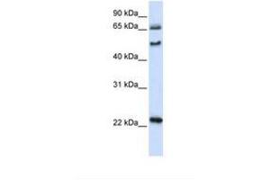 Image no. 1 for anti-UNC Homeobox (UNCX) (AA 74-123) antibody (ABIN6739205) (UNCX 抗体  (AA 74-123))