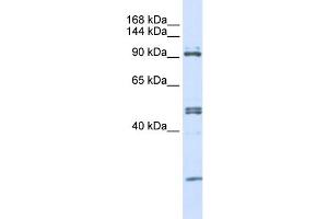 WB Suggested Anti-AARS Antibody Titration:  0. (AARS 抗体  (N-Term))