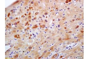 Immunohistochemistry (IHC) image for anti-Core 1 Synthase, Glycoprotein-N-Acetylgalactosamine 3-beta-Galactosyltransferase, 1 (C1GALT1) (AA 185-220) antibody (ABIN1387755)