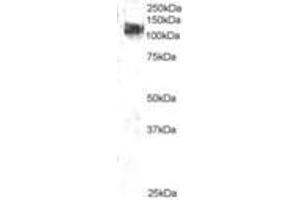 Image no. 1 for anti-Cas-Br-M (Murine) Ecotropic Retroviral Transforming Sequence (CBL) (AA 893-906) antibody (ABIN292894) (CBL 抗体  (AA 893-906))