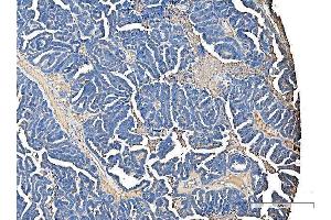 IHC analysis of Serum Amyloid P/APCS using anti-Serum Amyloid P/APCS antibody (ABIN5693182). (APCS 抗体  (AA 20-220))