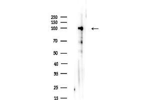 Western blot analysis of lysates from Rat lung, using TACC1 Antibody at 1/1000 dilution.