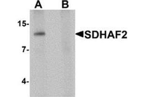 Western blot analysis of SDHAF2 in rat liver tissue lysate with SDHAF2 antibody at 1 ug/mL in (A) the absence and (B) the presence of blocking peptide. (Sdhaf2 抗体  (N-Term))