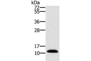 Western Blot analysis of Human prostate tissue using MSMB Polyclonal Antibody at dilution of 1:250 (MSMB 抗体)
