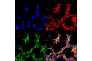 Immunocytochemistry/Immunofluorescence analysis using Rabbit Anti-HSP70 Acetyl Lys77 Polyclonal Antibody (ABIN5650763). (HSP70 抗体  (acLys77) (Atto 594))