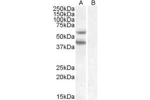 Image no. 1 for anti-Diacylglycerol O-Acyltransferase 2 (DGAT2) (C-Term), (Internal Region) antibody (ABIN374843) (DGAT2 抗体  (C-Term, Internal Region))