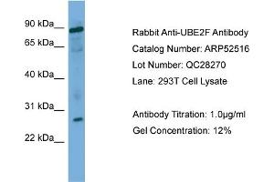 WB Suggested Anti-UBE2F  Antibody Titration: 0. (UBE2F 抗体  (Middle Region))