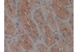 Detection of TEP1 in Human Kidney Tissue using Polyclonal Antibody to Telomerase protein component 1 (TEP1) (TEP1 抗体  (AA 2368-2627))