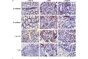 Effects of celastrol (2 mg/kg) on the expression levels of EMT-related proteins in AOM/DSS-treated mice. (SNAI1, SNAI2, SNAI3 (AA 188-264) 抗体)