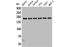 Western Blot analysis of SKOV3 BT474 Jurkat PC-3 U937 MCF7 cells using SCP-2 Polyclonal Antibody (SYCP2 抗体  (Internal Region))