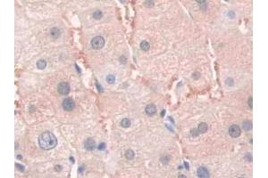 IHC-P analysis of Human Liver Tissue, with DAB staining. (SFRP4 抗体  (AA 25-222))