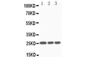 Anti-SOCS3 antibody, Western blotting Lane 1: JURKAT Cell Lysate Lane 2: CEM Cell Lysate Lane 3: RAJI Cell Lysate (SOCS3 抗体  (Middle Region))