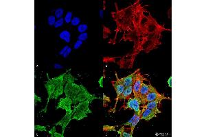Immunocytochemistry/Immunofluorescence analysis using Mouse Anti-ASIC1 Monoclonal Antibody, Clone S271-44 . (ASIC1 抗体  (AA 460-526))
