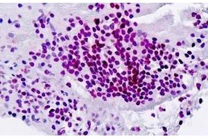 Immunohistochemistry (IHC) image for anti-Spleen Focus Forming Virus (SFFV) Proviral Integration Oncogene Spi1 (SPI1) (AA 217-246) antibody (ABIN1804568)