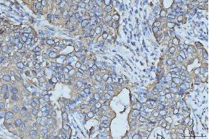 IHC analysis of Cytokeratin 5 using anti-Cytokeratin 5 antibody (ABIN7602992). (Cytokeratin 5 抗体  (Middle Region))