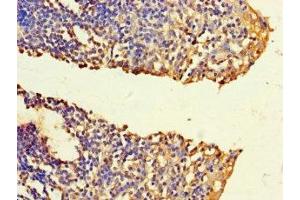 Immunohistochemistry of paraffin-embedded human tonsil tissue using ABIN7165586 at dilution of 1:100 (FNTB 抗体  (AA 1-300))