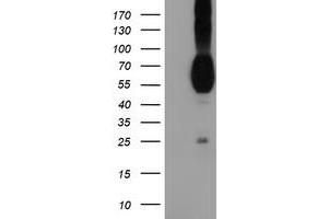 HEK293T cells were transfected with the pCMV6-ENTRY control (Left lane) or pCMV6-ENTRY PVRL1 (Right lane) cDNA for 48 hrs and lysed. (PVRL1 抗体)
