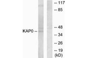 Western blot analysis of extracts from HepG2 cells, using KAP0 Antibody. (PRKAR1A 抗体  (AA 271-320))