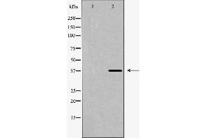 Western blot analysis of SUCNR1 expression in HUVEC cells. (SUCNR1 抗体  (Internal Region))