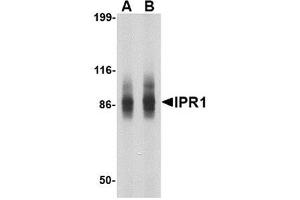 Western blot analysis of IPR1 in SW480 cell lysate with IPR1 antibody at (A) 1 and (B) 2 μg/ml. (SP110 抗体  (N-Term))